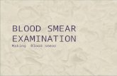 Blood smear examination