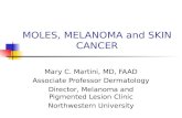 MOLES, MELANOMA and SKIN CANCER