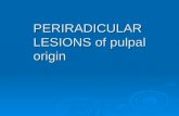 PERIRADICULAR LESIONS  of  pulpal  origin