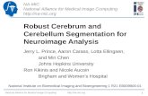 Robust Cerebrum and Cerebellum Segmentation for Neuroimage Analysis