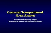 Corrected Transposition of  Great Arteries