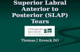 Superior Labral Anterior to Posterior (SLAP) Tears