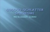 Osgood- schlatter  syndrome
