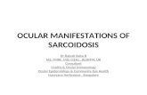 OCULAR MANIFESTATIONS OF SARCOIDOSIS
