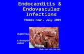 Endocarditis &  Endovascular Infections