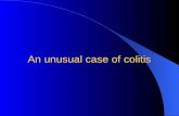 An unusual case of colitis