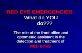 RED EYE EMERGENCIES : What do YOU      do???