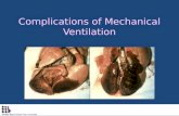 Complications of Mechanical Ventilation