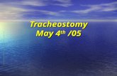 Tracheostomy May 4 th  /05