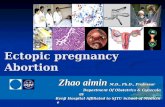 Ectopic pregnancy Abortion