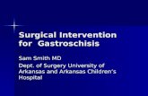 Surgical Intervention for  Gastroschisis