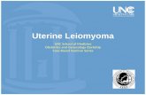 Uterine Leiomyoma