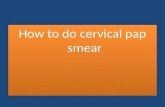 How to do cervical pap smear