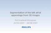 Segmentation of the left  atrial  appendage from 3D images
