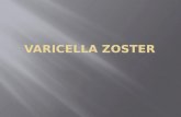 Varicella zoster