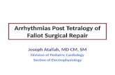 Arrhythmias Post  Tetralogy  of  Fallot  Surgical Repair