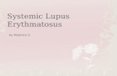 Systemic Lupus Erythmatosus