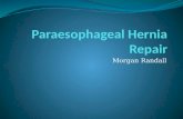Paraesophageal  Hernia Repair