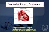 Valvular  Heart Diseases