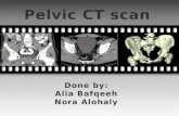 Pelvic CT scan