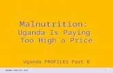 Malnutrition:  Uganda Is Paying  Too High a Price