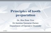 principle cavity preparation