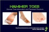 Hammer Toes Information & Treatments