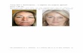 The Non Surgical Facelift