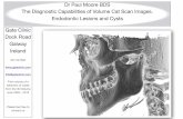 Cat Scan Volume 1 Endodontic Lesions and Cysts