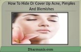 How To Hide Or Cover Up Acne, Pimples And Blemishes