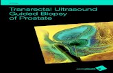 Urology - TRUS Biopsy