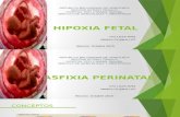 Hipoxia Fetal
