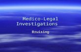 Medico-Legal Investigations Bruising. What is a Contusion?  Bleeding under intact skin due to heavy blunt instrument –Hemorrhage into the skin, the tissues.