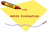 Ankle Evaluation. History How did this injury occur? –Mechanism of injury When? Where does it hurt? Did you hear any sounds or feel a pop? Any previous.