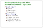 Pathophysiology of the Musculoskeletal System Joint Injury Sprain Subluxation Dislocation Bone Injury Open Fracture Closed Fracture Hairline Fracture Impacted.