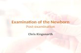 Examination of the Newborn Post-examination Chris Kingsnorth.