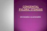 DR.RANDA ALGHANEM.  DEFINITION  INCIDENCE  ETIOLOGY  CLINICAL PRESENTATION  DIAGNOSIS  MANEGEMENT.