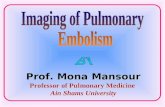 Prof. Mona Mansour Professor of Pulmonary Medicine Ain Shams University.