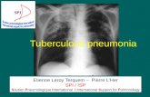 Tuberculous pneumonia Etienne Leroy Terquem – Pierre L’Her SPI / ISP Soutien Pneumologique International / International Support for Pulmonology.