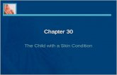 Chapter 30 The Child with a Skin Condition. Skin Disorders and Variations Macule Papule Vesicle Pustule Crust Wheal Ecchymosis The nurse should describe.