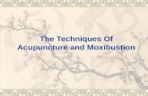 The Techniques Of Acupuncture and Moxibustion. Filiform Needle Manipulation