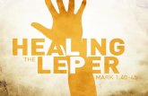 Jesus Heals The Leper. Learning From The Leper’s Faith A Bold Faith: He “came to Jesus” A Dependant Faith: “beseeching Him” A Humble Faith: “falling on.