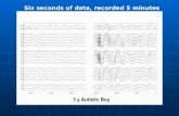 Six seconds of data, recorded 5 minutes apart. Electroencephalography First recording of electrical fields of animals, Caton (1875); humans, Berger.