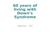 60 years of living with Down’s Syndrome Debbie Race2015.