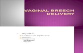 CH08 Vaginal Breech Delivery - Copy