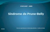 SíndromedePrune-Belly Síndrome de Prune-Belly Curso de especialização em fisioterapia pediátrica - Carolina da Rocha Salvador UNICAMP - 2009 UNICAMP -