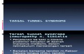 Tarsal Tunnel Syndrome 2009 Reg