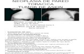 Neoplasia de Pared Toracica