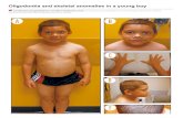 Oligodontia and Skeletal Anomalies in a Young Boy Contemporarypediatrics.modernmedicine.com