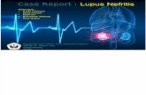 Case Report Lupus Nefritis